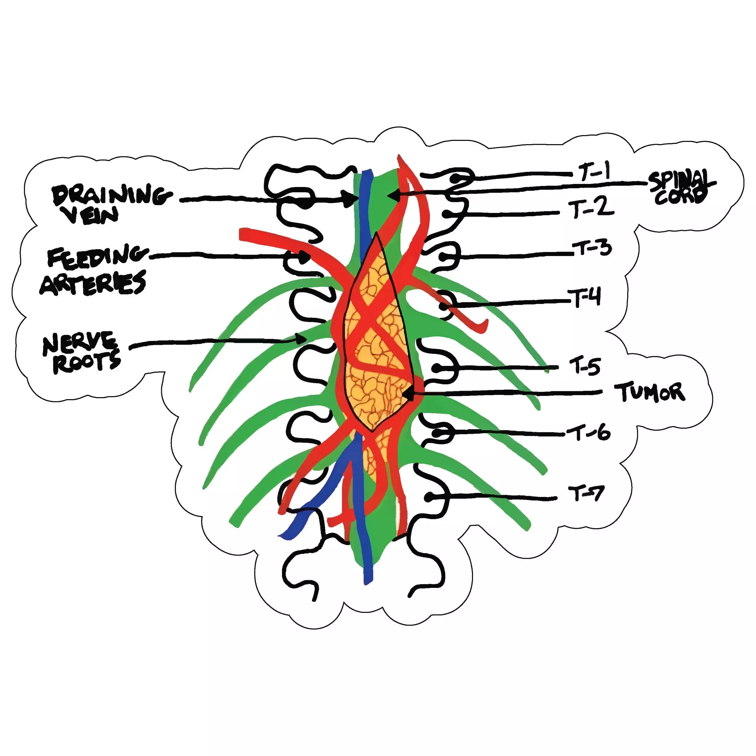 Spinal Diagram - Meme - Sticker